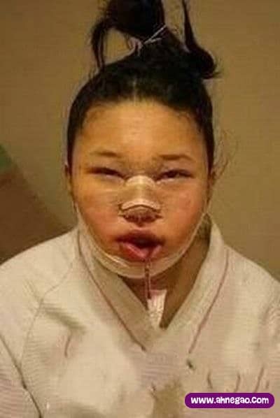 plastic_surgery_02