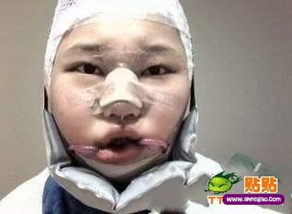 plastic_surgery_03