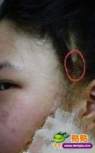 plastic_surgery_04
