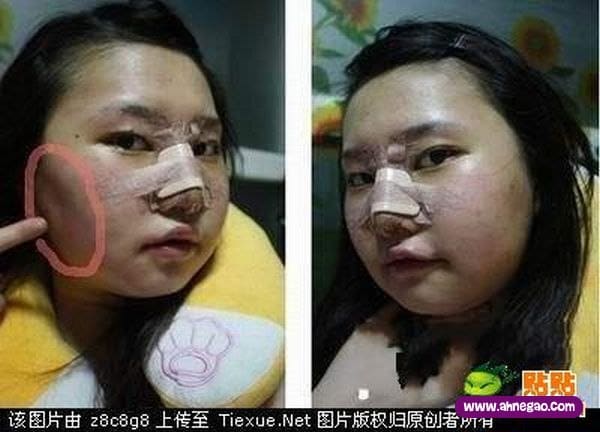 plastic_surgery_05