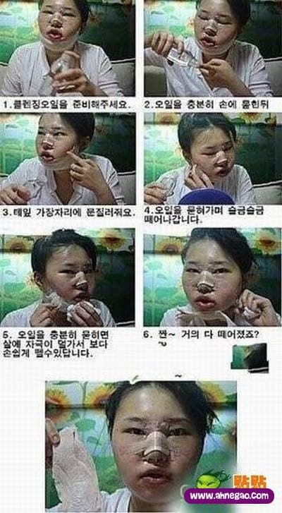 plastic_surgery_06