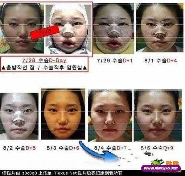 plastic_surgery_07
