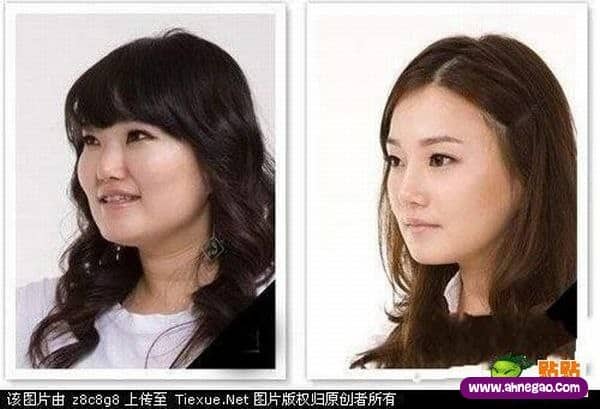plastic_surgery_09